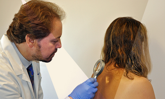 Skin Cancer Screening