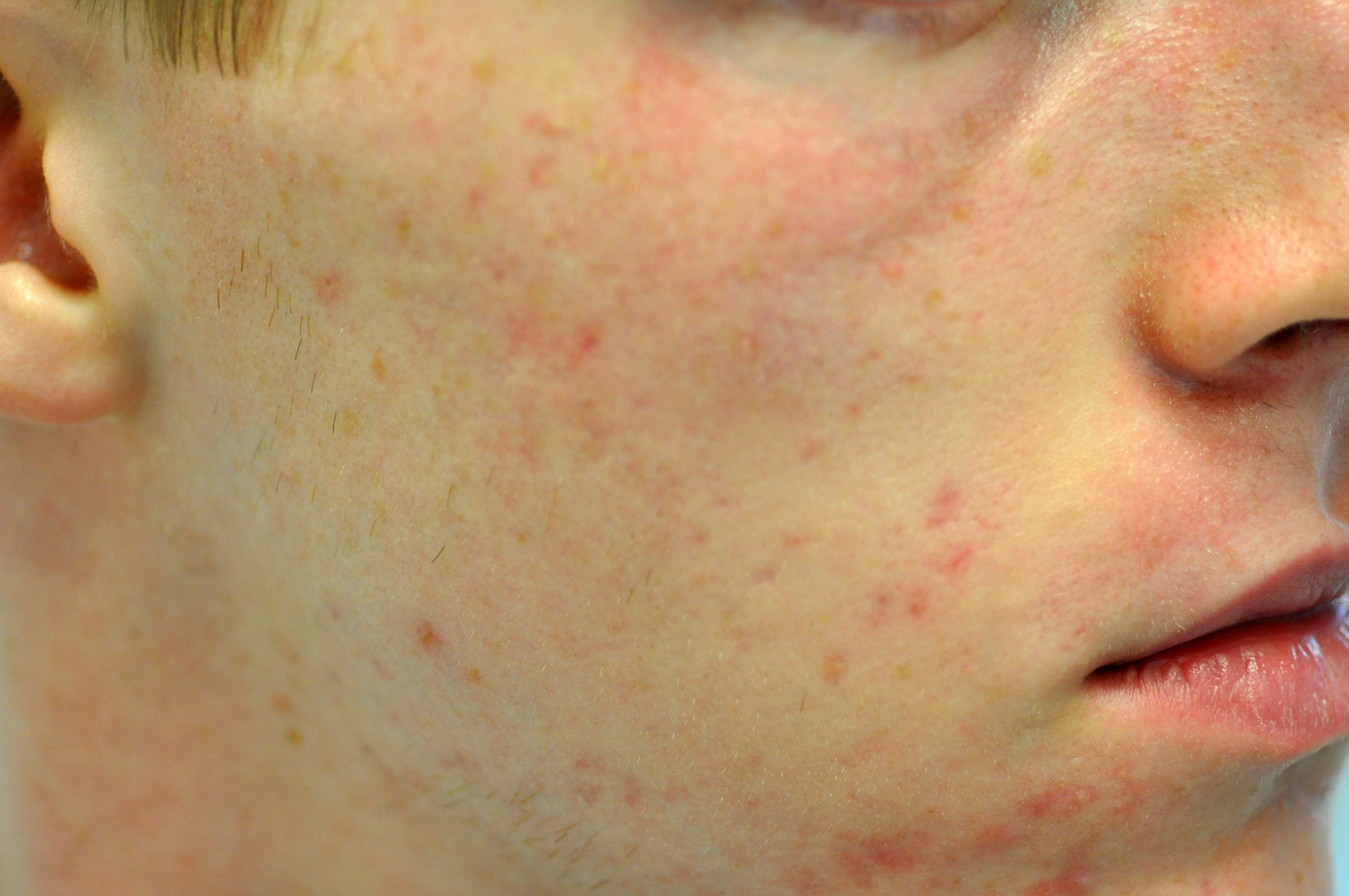 Pixel Before - Gk Dermatology, Pc