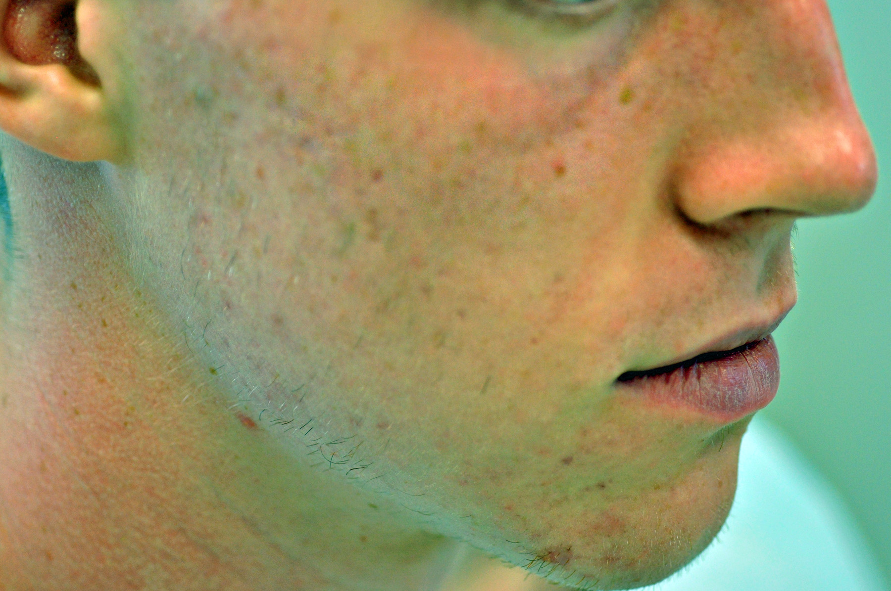 Pixel After - Gk Dermatology, Pc