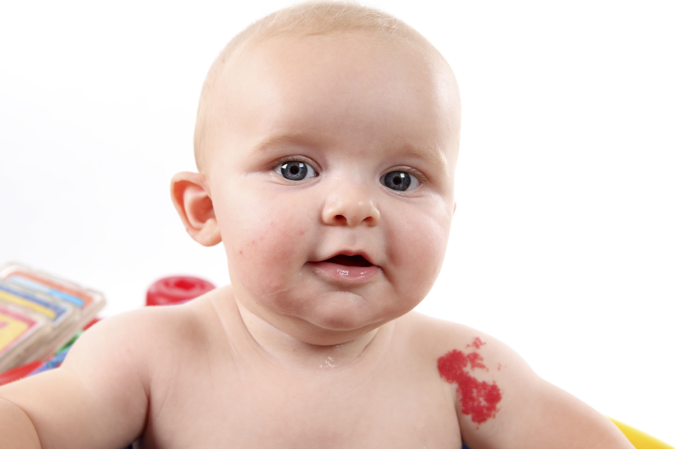 Почему младенцы красные. Пиодермия стрептодермия. Стрептодермия у новорождённых. Пигментная гемангиома.